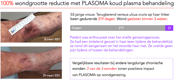 Wond van 219 dagen gesloten binnen 3 weken met PLASOMA.