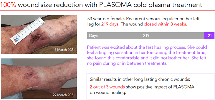 Wound images before and after PLASOMA