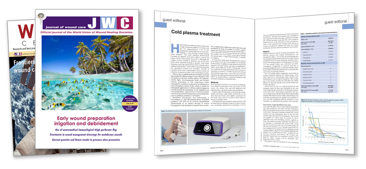 JWC Article cold plasma treatment